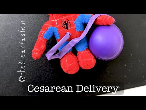 Playdough Surgery 🔪🤰🏻- Cesarean Delivery