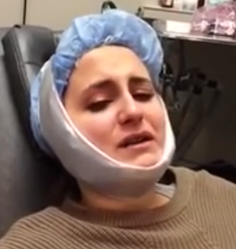 funny videos, funny vids, funny video, after wisdom teeth removal, after wisdom teeth removal video, wisdom teeth aftermath, funny wisdom teeth video, harry potter, daniel radcliffe