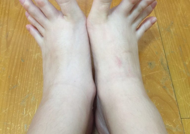 toes look like fingers, creepy toes, weird toes, toes like fingers, finger toes, weird feet, creepy feet, feet look like hands, weird stuff, weird shit, creepy stuff, creepy shit, creepy, weird