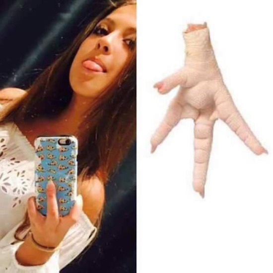 image of girl's hand looks like a chicken foot