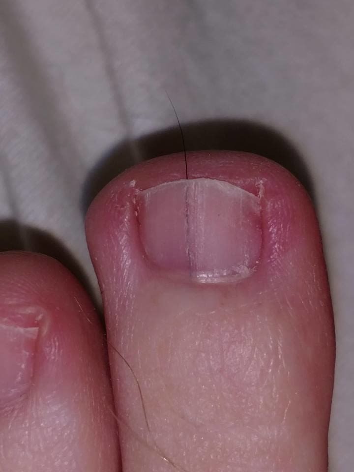 hair coming out of toenail cursed image, hair coming out of toenail cursed picture, hair coming out of toenail curse pic, cursed images, cursed image meme, r/cursed images, rcursed images, r cursed images, weird images, random images, edgy cursed images