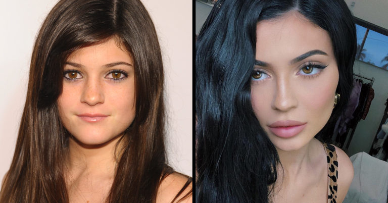 35 Pictures Of Celebs In 2009 Vs. 2019