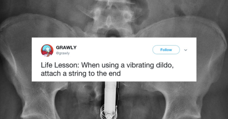 Guy’s Story Of Visiting The ER After Getting A Vibrating Dildo Stuck Up His A** Is Truly Hilarious