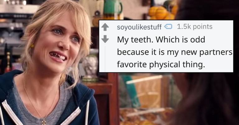 People Are Sharing The Physical ‘Flaws’ Nobody Notices But Them, And Awww