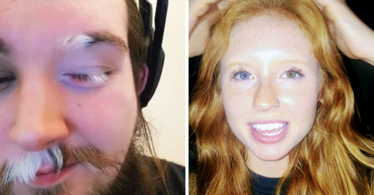 15 Times Genetics Gave Us Beautiful Surprises