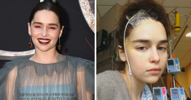 Emilie Clarke Reveals That A Piece Of Her Brain ‘Actually Died’ After Second Aneurysm
