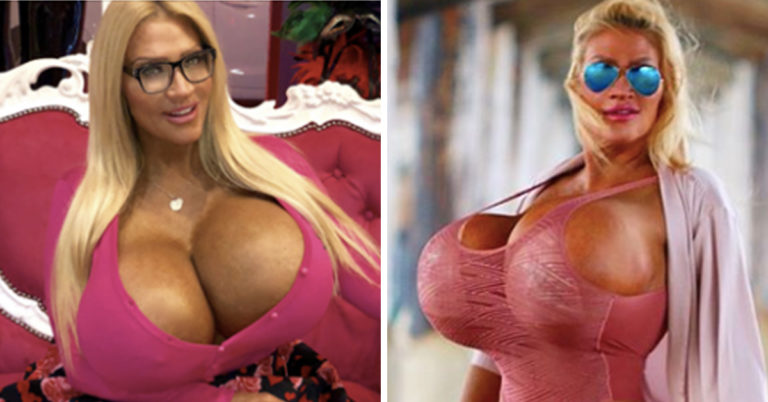 This Mom Started A Business Where Women Can Crowdfund Their Plastic Surgery