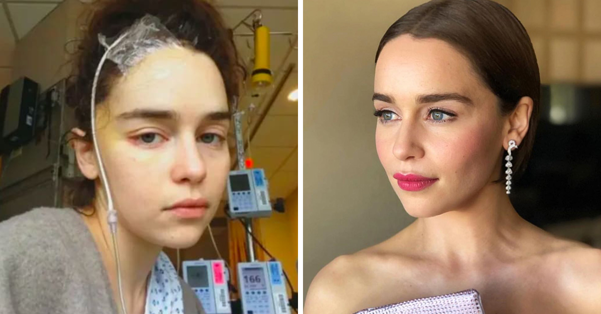 Emilia Clarke Says She Hated Her Own Reflection After Brain Aneurysm Surgery