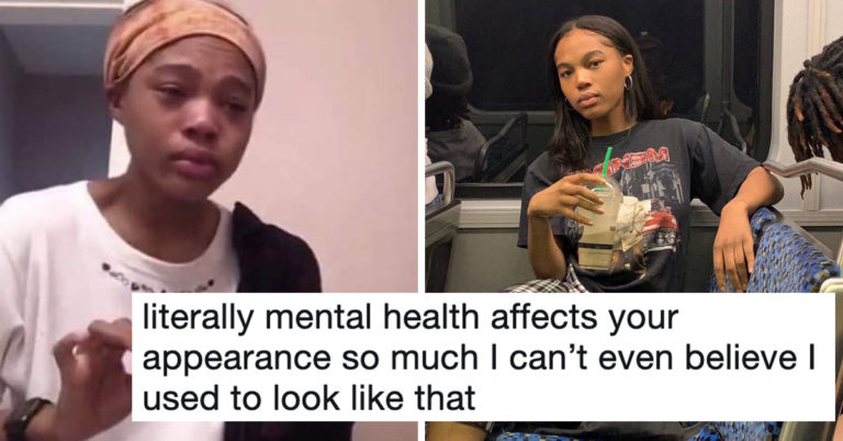 These Photos Of Mental Health Glow-Ups Show How Severely Depression Affects Your Appearance