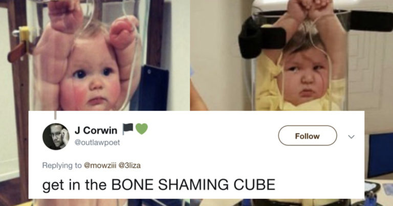This Is What Baby X-Rays Look Like, So Naturally Twitter’s Got Jokes