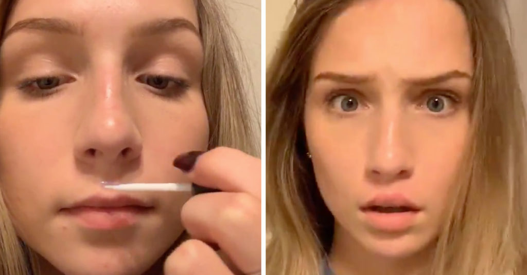 Lip Glue Challenge TikTok Teens Use Glue To Make Their Lips Bigger