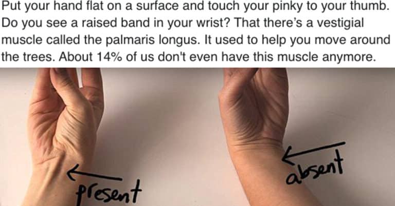 Scientist Shares The Freaky Useless Stuff Leftover On Human Bodies Via Evolution