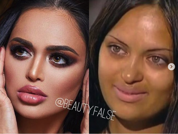 Beauty-False Exposes Influencers Who Lie About Their Appearances (30 Pics)