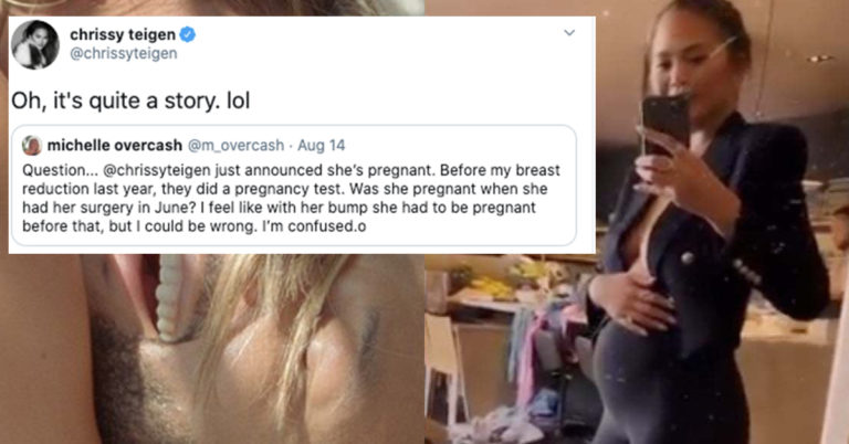 Chrissy Teigen Shares How She Found Out She Was Pregnant Right Around Her Boob Reduction