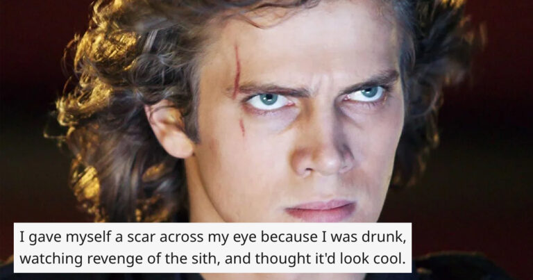 People Are Swapping Stories Of The “Dumbest Ways” They Got Scars (20 Stories)