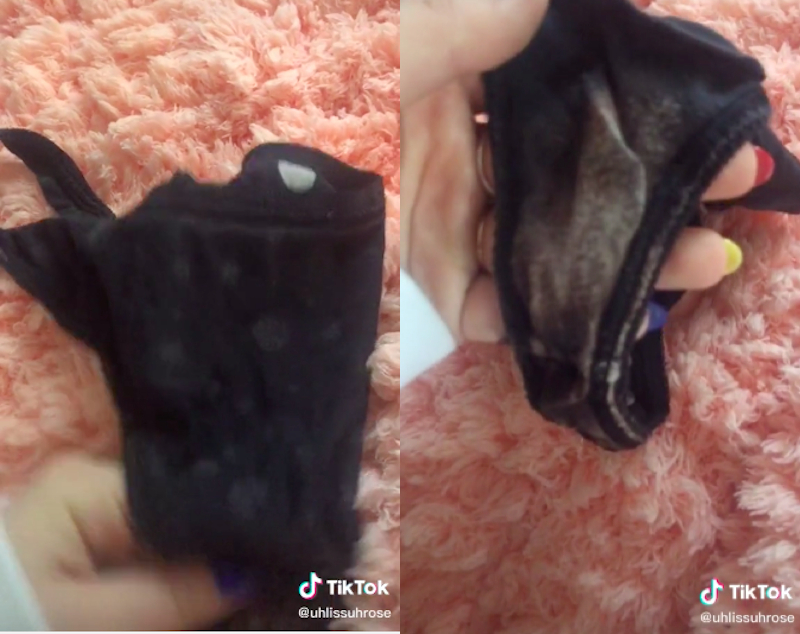 TikTok Explaining (Totally Normal!) Underwear Bleach Stains Goes Viral