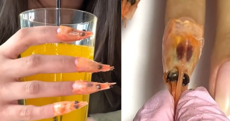 Nail Salon Gets Ripped For Dead Shrimp Head Manicure