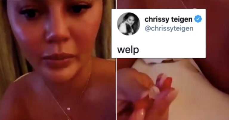 chrissy teigen tooth