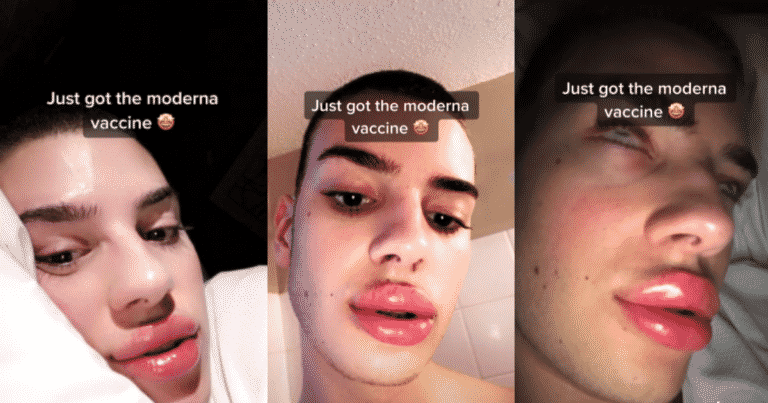 moderna vaccine, moderna vaccine lip filler, moderna vaccine filler, moderna vaccine fillers, covid vaccine lip filler, covid vaccine lip fillers, covid vaccine filler, covid vaccine fillers