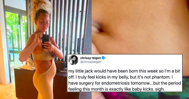 Chrissy Teigen Still Feels Belly Kicks On The Day Her Son Jack Would've Been Born