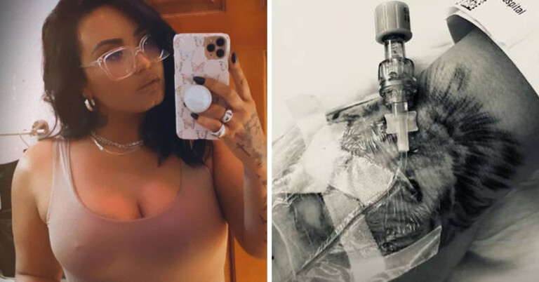“I Had Three Strokes”—Demi Lovato Reveals New Details About Overdose
