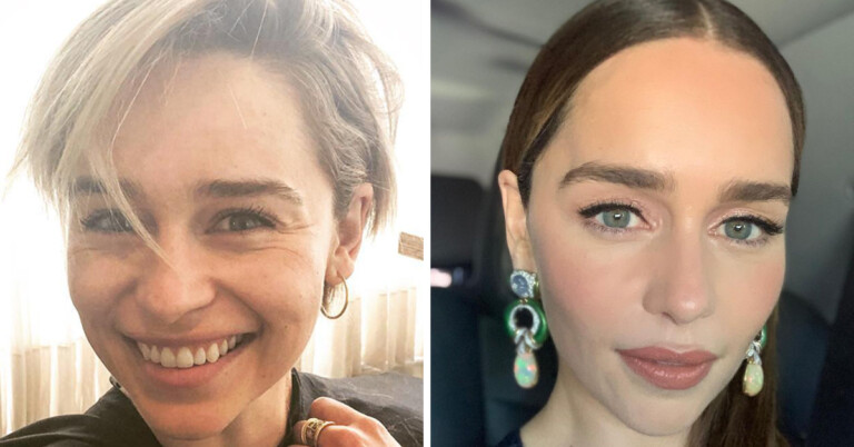 Emilia Clarke Tells The Story Of Kicking Out A Facialist Who Said She Needed Fillers