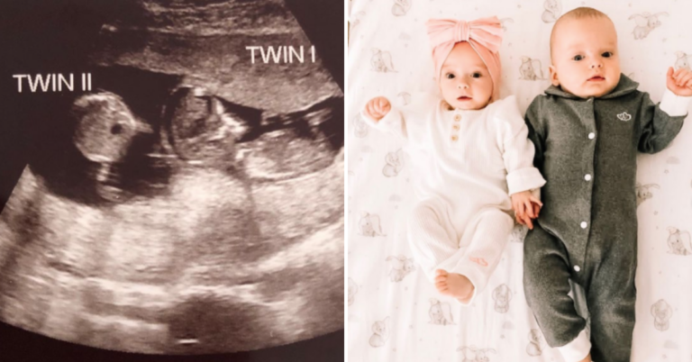 Woman Gets Pregnant While Already Pregnant, Delivers Surprise Twins