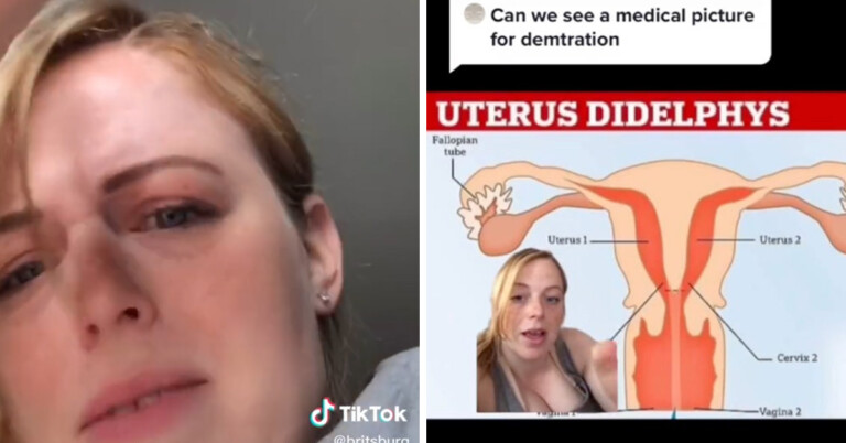 Woman Discovers She Has Two Vaginas After Going Into Labor