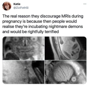 Doctors Don't Want You To See Pregnancy MRIs Because They're Terrifying