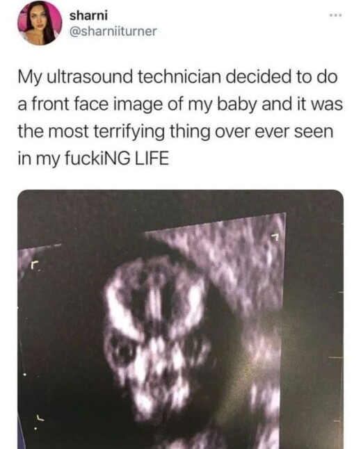 Doctors Don't Want You To See Pregnancy MRIs Because They're Terrifying