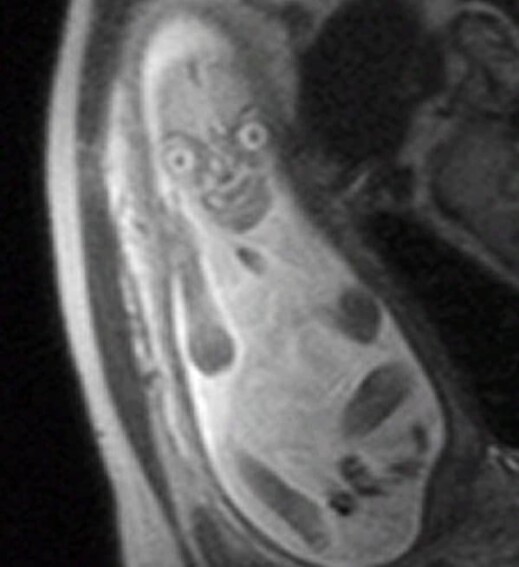 Doctors Don't Want You To See Pregnancy MRIs Because They're Terrifying