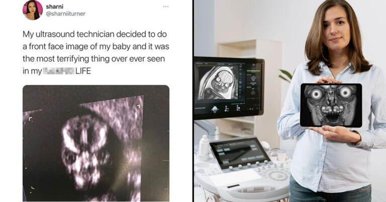 Terrifying And Hilarious Pregnancy MRIs That Could Cure Anyone’s Baby Fever