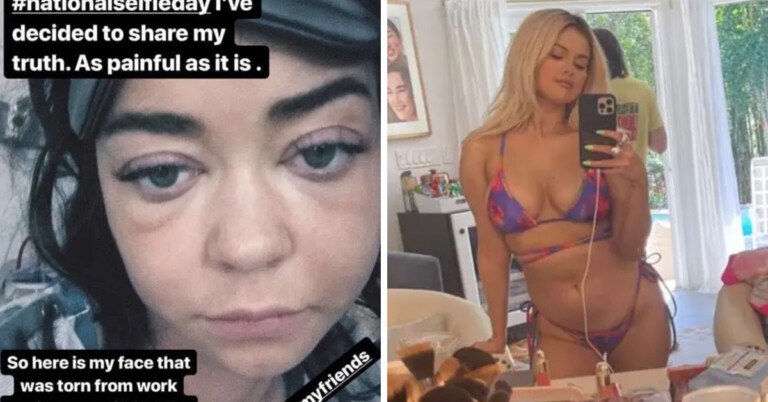 20 Times Celebrities Shared Real, Unretouched Photos Of Themselves