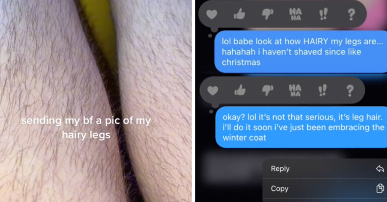 Girlfriend Sends Boyfriend A Pic Of Her Hairy Legs And Gets Shamed