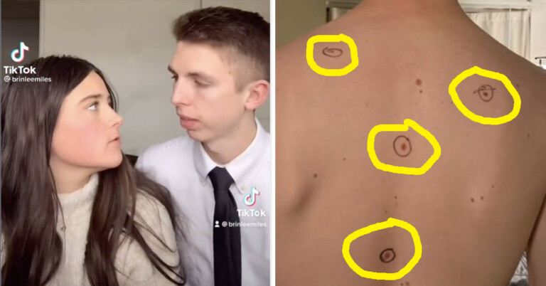 Wife Circles Moles Before Doctor’s Appointment, Doctor Sends Him Back With Notes Written On His Body