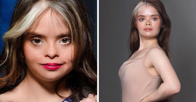 Model With Down Syndrome Inspires Others While Taking The Beauty Industry By Storm