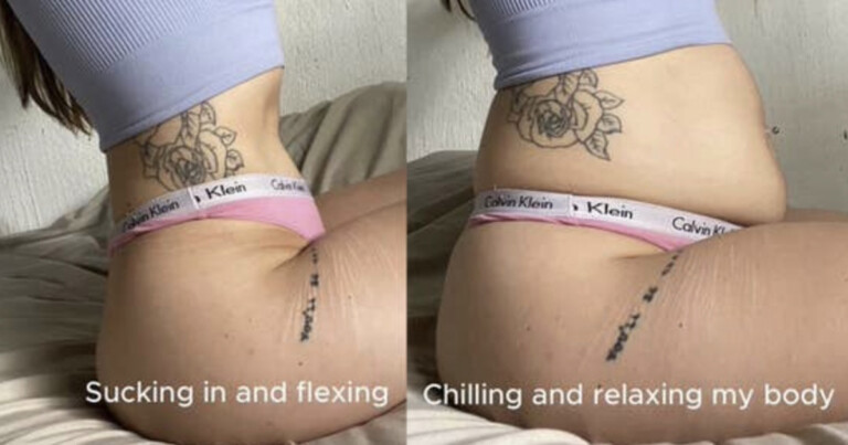 Woman’s Posed Vs. Unposed Pics Expose How Fake Social Media Can Be