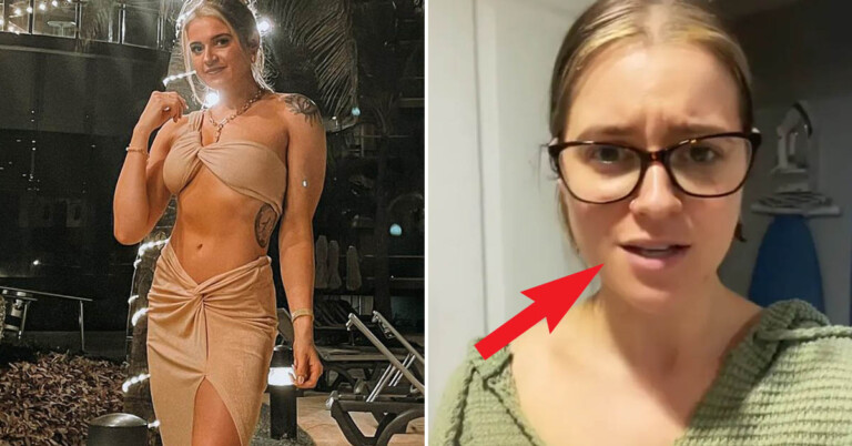 People Are Reacting After This Woman’s Esthetician Found Beads From A Popular Wash Stuck In Her Pores