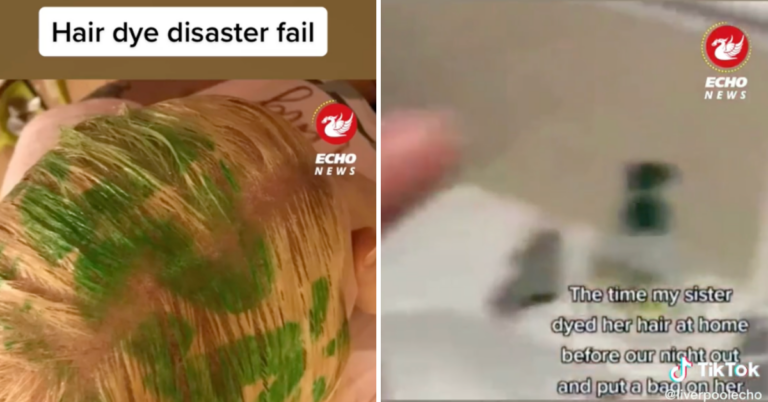 Woman Gets Shopping Bag Logo Painted On Head In Home Hair Dye Disaster