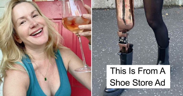 25 Unedited Pics Proving Real Beauty Is Way Different Than The Photoshopped Perfection We See On Instagram