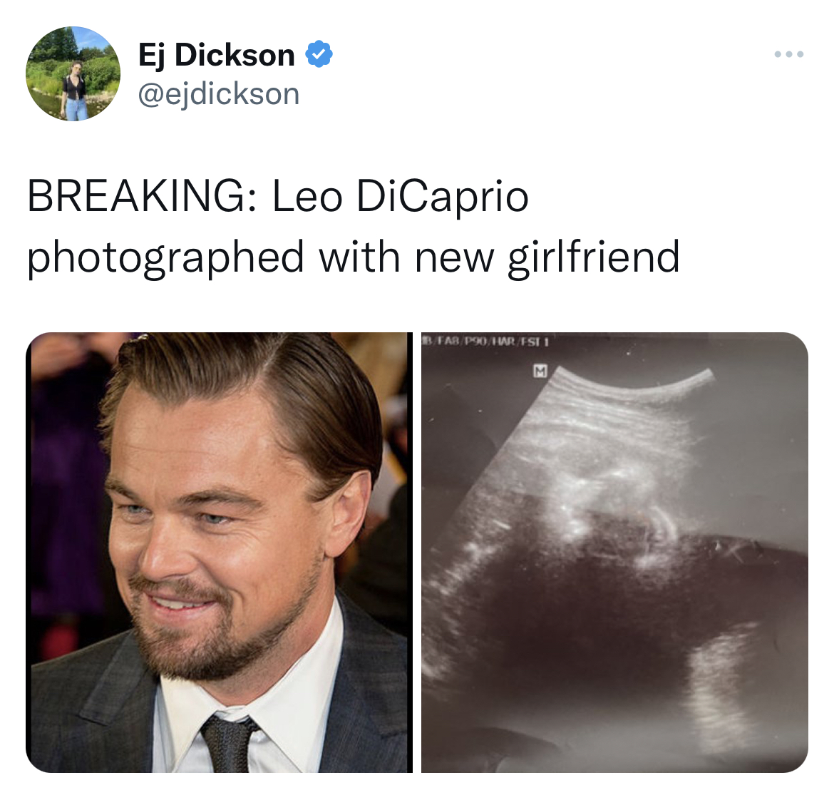 leonardo dicaprio dating a teenager meme - sonogram 