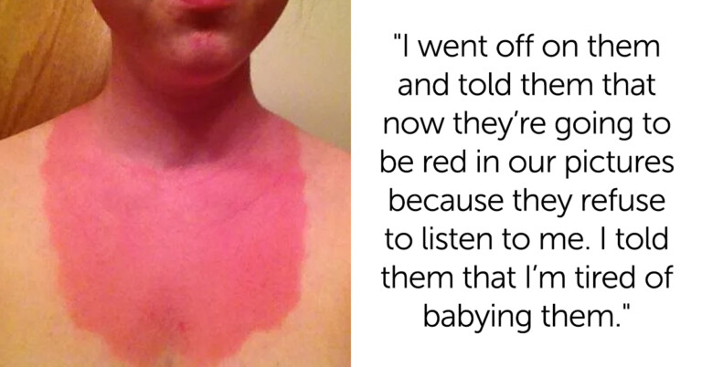 “AITA For Being Pissed At My Future Spouse For Getting Sunburned 3 Days Before Our Wedding?”